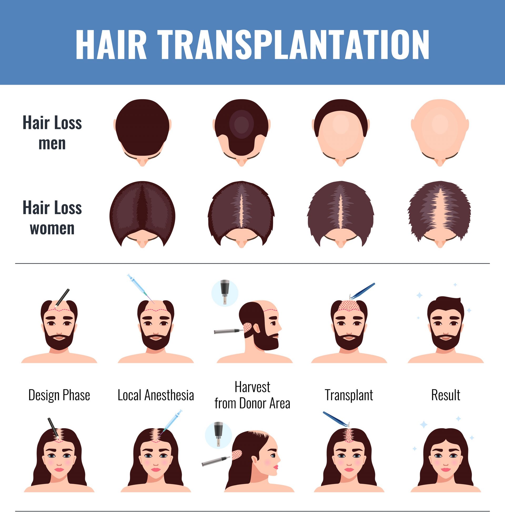 Hair Transplant Selecting the Right Extraction Method